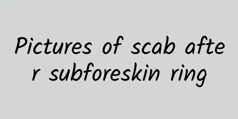 Pictures of scab after subforeskin ring