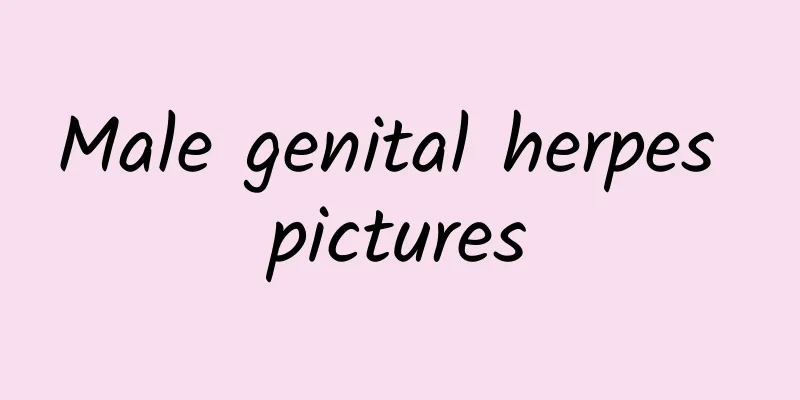 Male genital herpes pictures