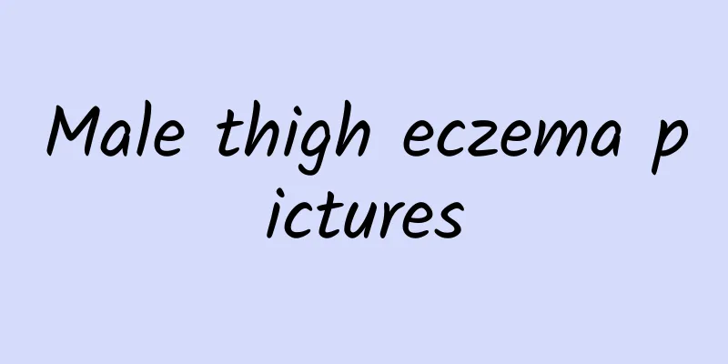 Male thigh eczema pictures