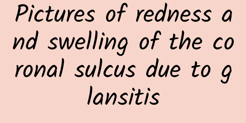 Pictures of redness and swelling of the coronal sulcus due to glansitis