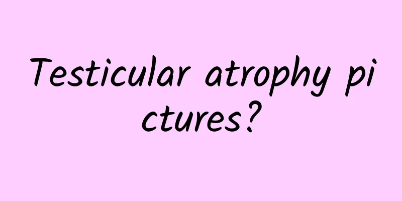 Testicular atrophy pictures?