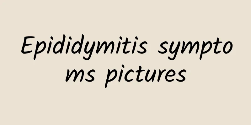 Epididymitis symptoms pictures