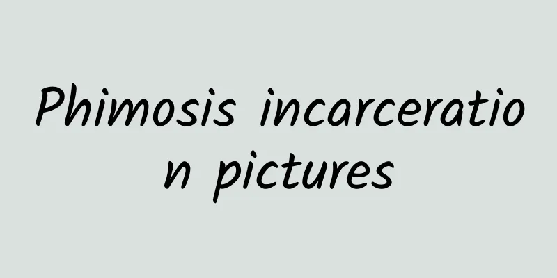 Phimosis incarceration pictures