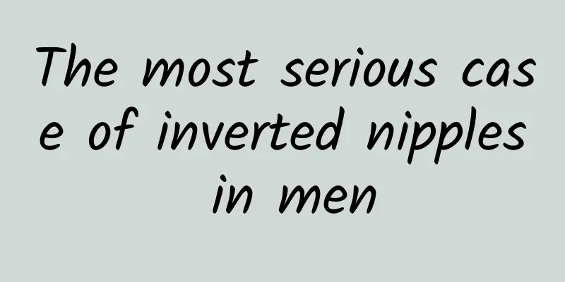 The most serious case of inverted nipples in men