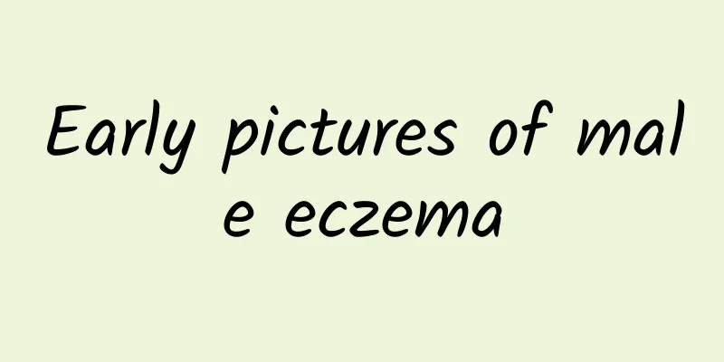 Early pictures of male eczema