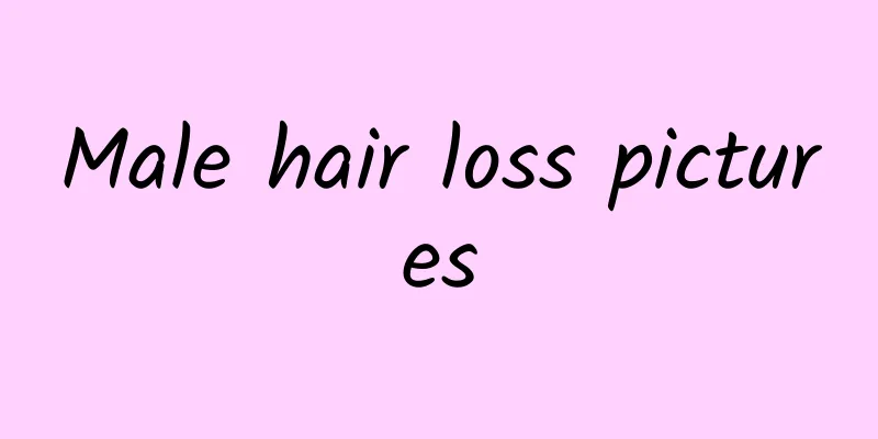 Male hair loss pictures