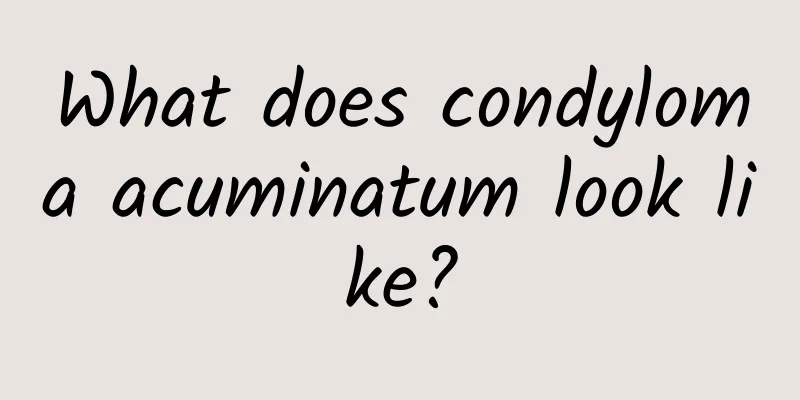 What does condyloma acuminatum look like?