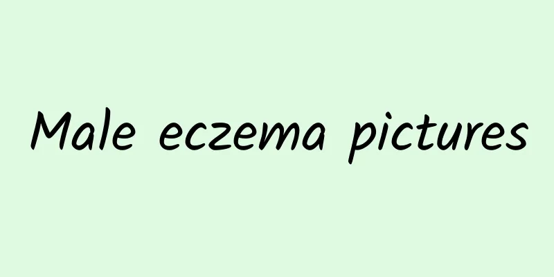 Male eczema pictures