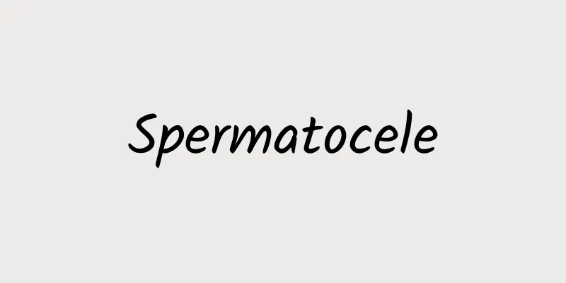 Spermatocele