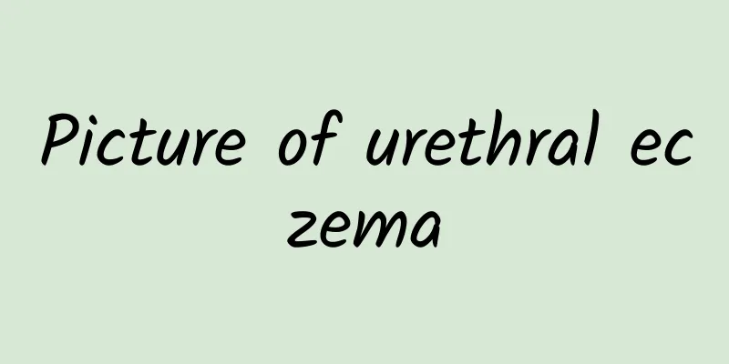Picture of urethral eczema