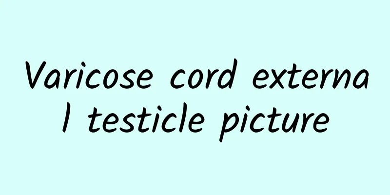 Varicose cord external testicle picture