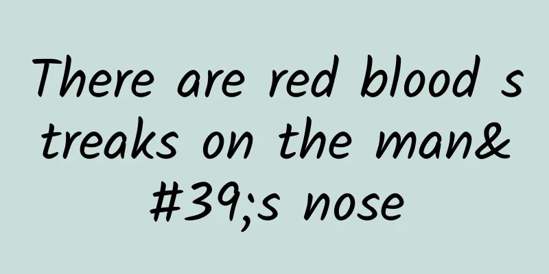 There are red blood streaks on the man's nose