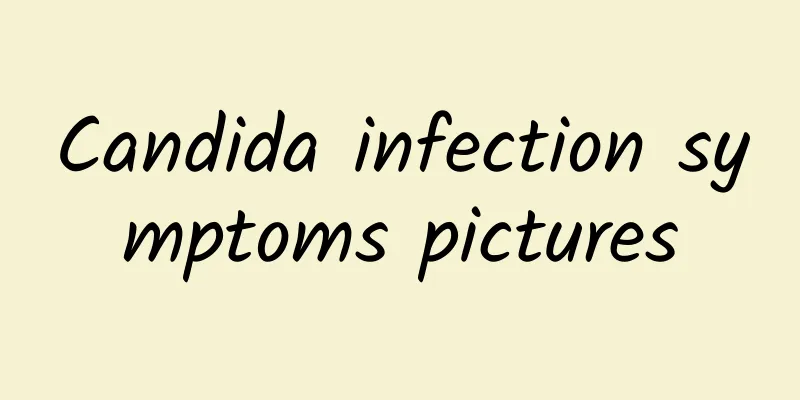 Candida infection symptoms pictures