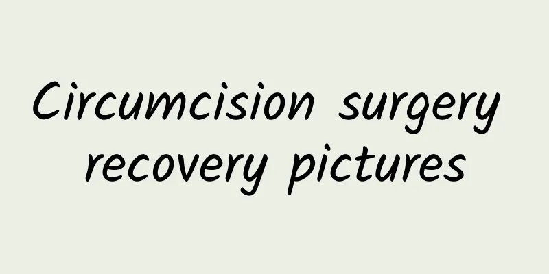 Circumcision surgery recovery pictures