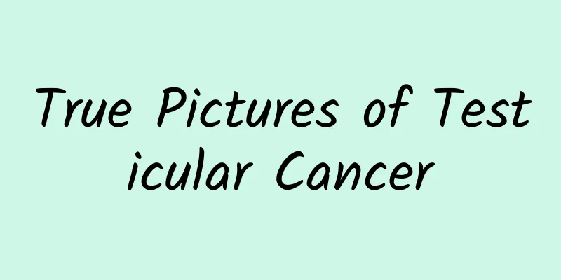 True Pictures of Testicular Cancer