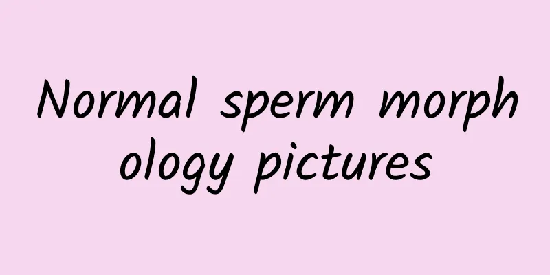 Normal sperm morphology pictures