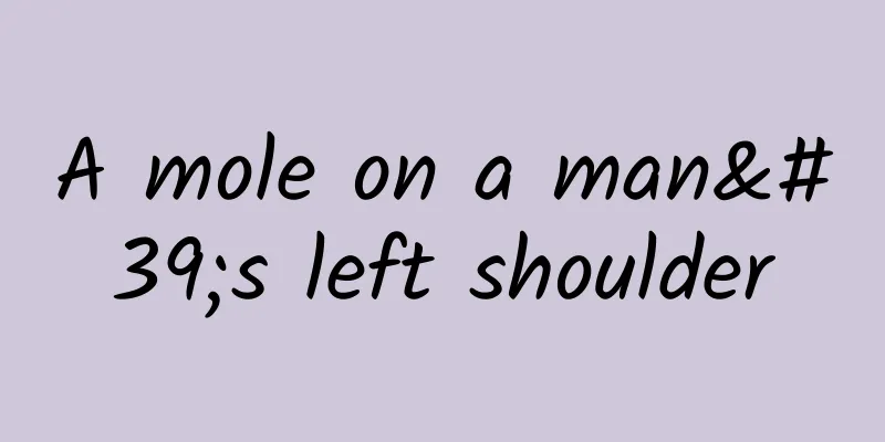 A mole on a man's left shoulder