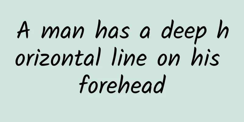 A man has a deep horizontal line on his forehead