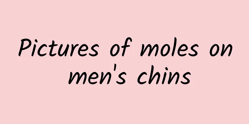 Pictures of moles on men's chins