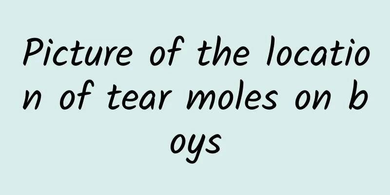Picture of the location of tear moles on boys