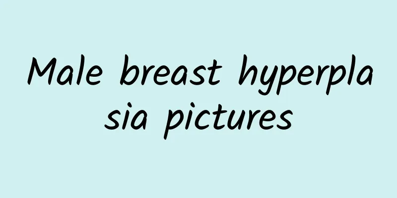 Male breast hyperplasia pictures