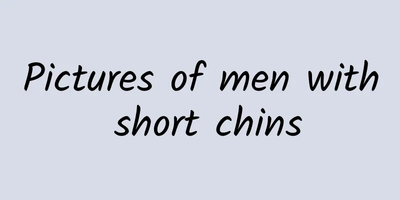 Pictures of men with short chins