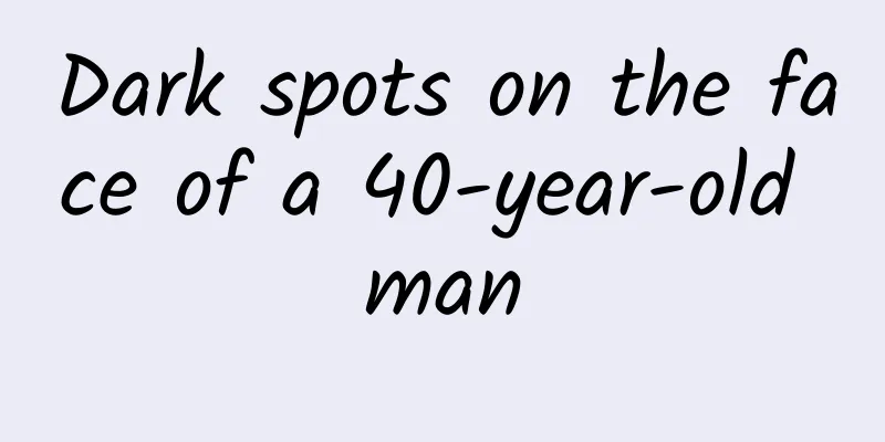 Dark spots on the face of a 40-year-old man