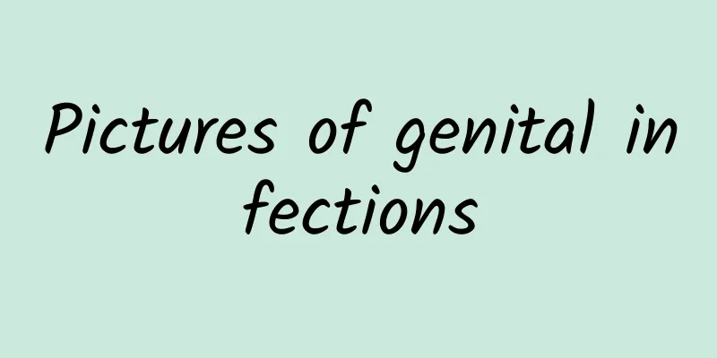 Pictures of genital infections