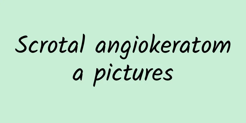 Scrotal angiokeratoma pictures