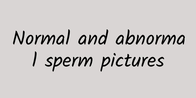 Normal and abnormal sperm pictures