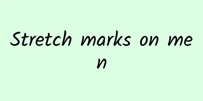 Stretch marks on men