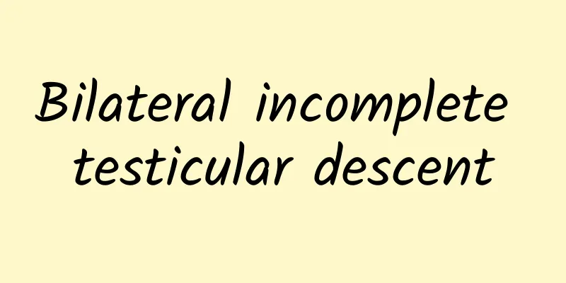 Bilateral incomplete testicular descent
