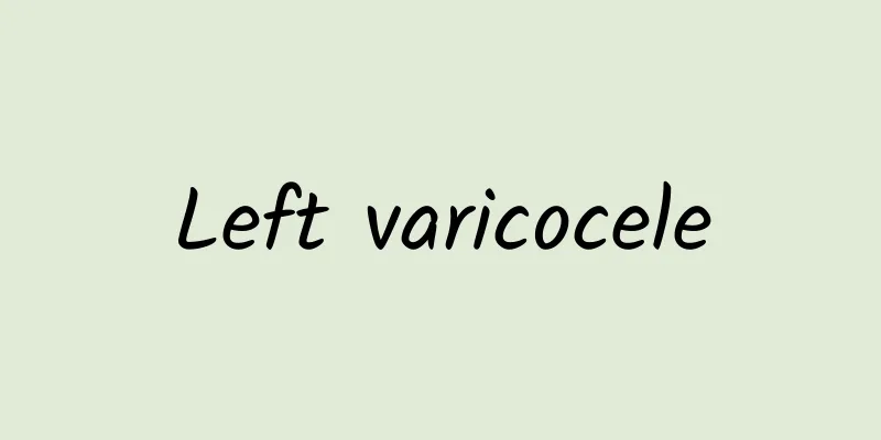 Left varicocele
