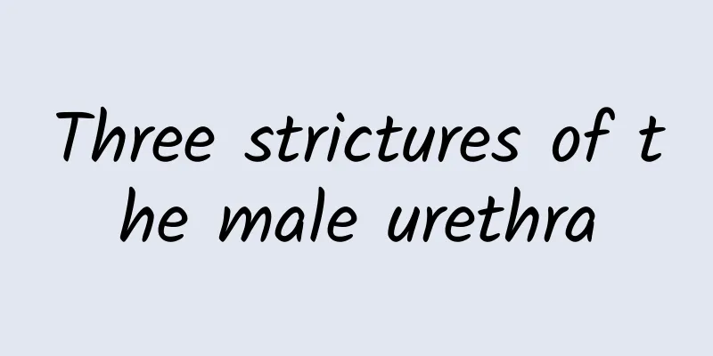 Three strictures of the male urethra