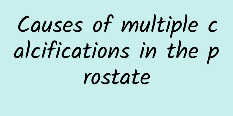 Causes of multiple calcifications in the prostate