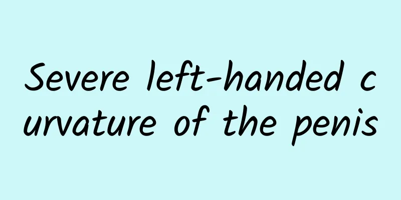 Severe left-handed curvature of the penis