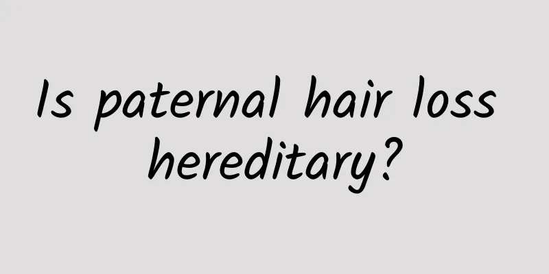 Is paternal hair loss hereditary?