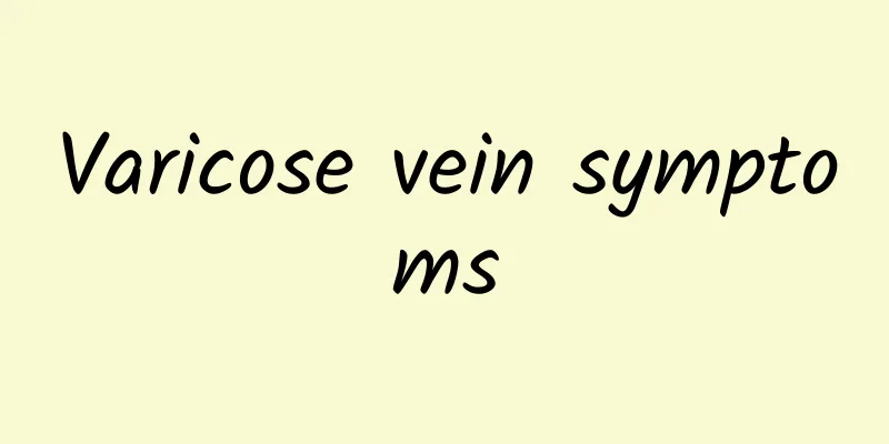 Varicose vein symptoms