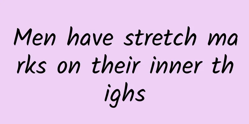 Men have stretch marks on their inner thighs