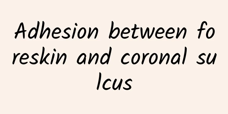Adhesion between foreskin and coronal sulcus