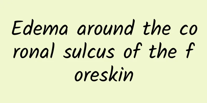 Edema around the coronal sulcus of the foreskin