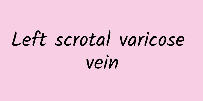Left scrotal varicose vein