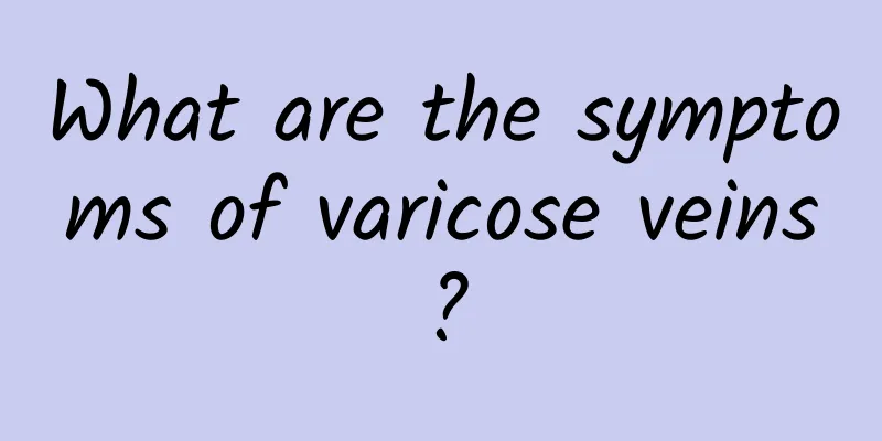 What are the symptoms of varicose veins?