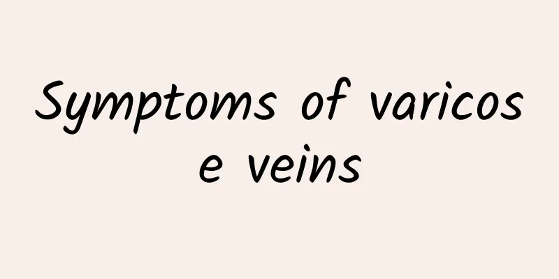 Symptoms of varicose veins