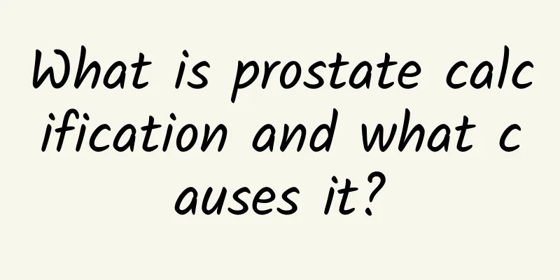 What is prostate calcification and what causes it?