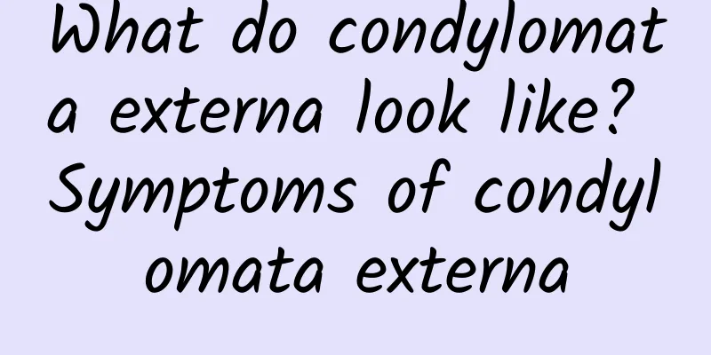 What do condylomata externa look like? Symptoms of condylomata externa