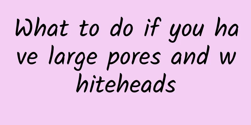 What to do if you have large pores and whiteheads