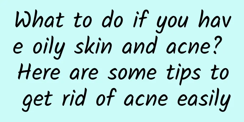 What to do if you have oily skin and acne? Here are some tips to get rid of acne easily