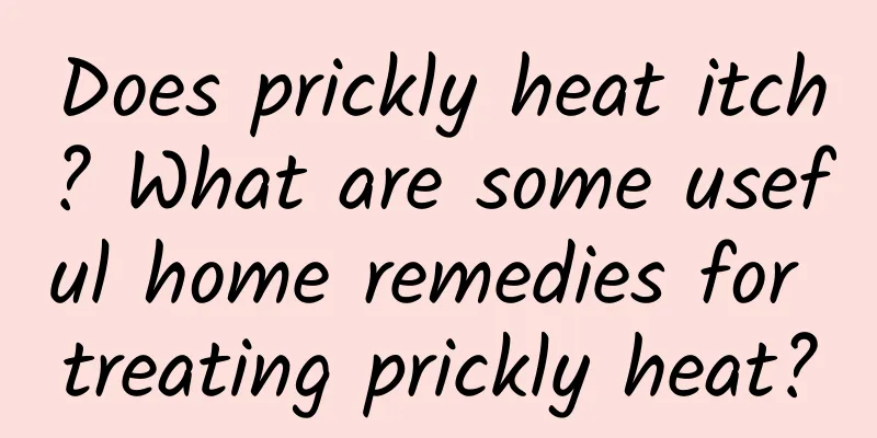 Does prickly heat itch? What are some useful home remedies for treating prickly heat?