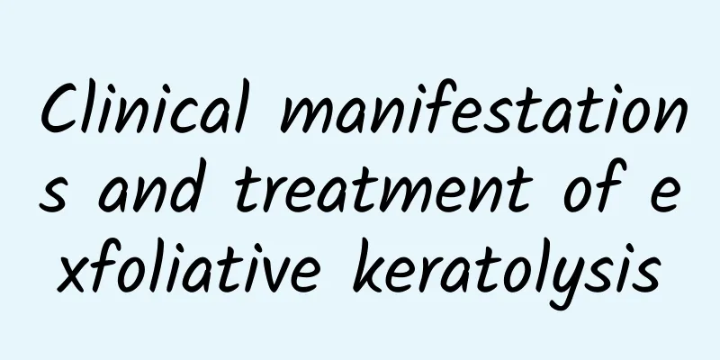 Clinical manifestations and treatment of exfoliative keratolysis